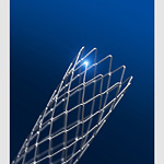 publications, thumbnail 11, Stent